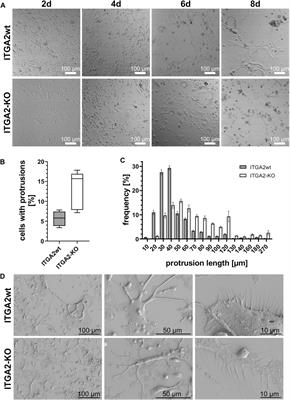 Integrin α2 is an early marker for osteoclast differentiation that contributes to key steps in osteoclastogenesis